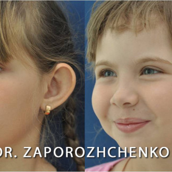 Павел Запорожченко, Одесса Фото - 11