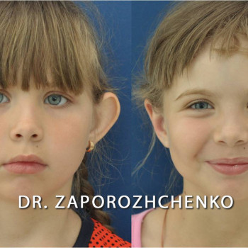 Павел Запорожченко, Одесса Фото - 12