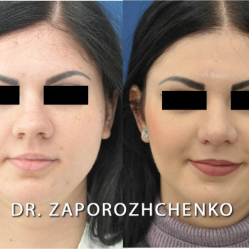 Павел Запорожченко, Одесса Фото - 13