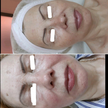 Фото с портфолио Анастасiя Прийтенко