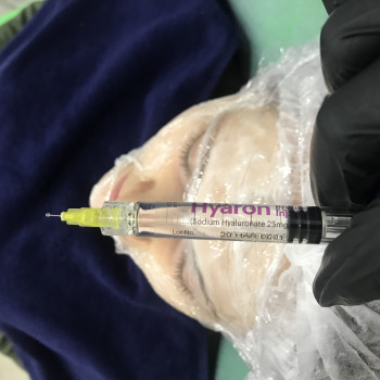 Мезотерапия
                    Врач-косметолог Карина Харьков