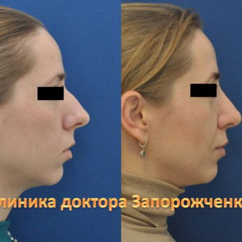 Павел Запорожченко, Одесса Фото - 8