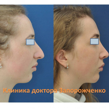 Павел Запорожченко, Одесса Фото - 14