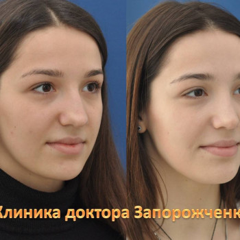 Павел Запорожченко, Одесса Фото - 15