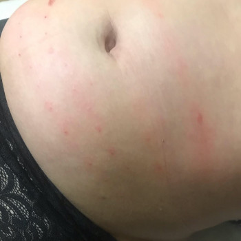 Липолитики
                    Врач-косметолог Карина Харьков