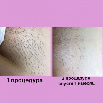 Ирина , Одесса Фото - 5