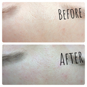 Чистка лица (механическая, ультразвуковая, комбинированная)
                    Мастер депиляции Ірина Киев