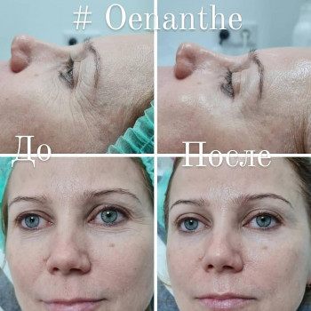 Оксана Лантух, Київ Фото - 12