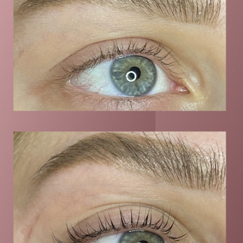 Анна Шульга, Чернігів Фото - 5