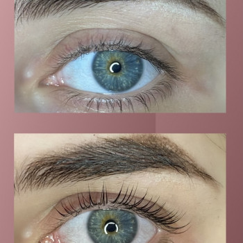 Анна Шульга, Чернігів Фото - 6