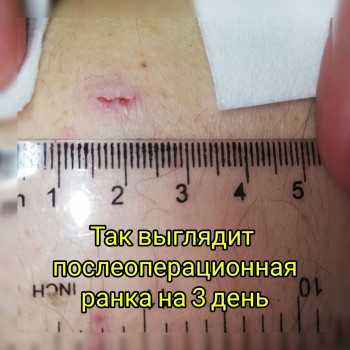 Наталия Мартыненко, Сумы Фото - 73