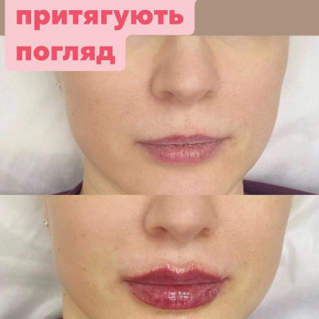 Елена Колесник, Хмельник Фото - 7