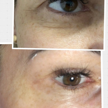 Алена Рыбкина, Днепр Фото - 17