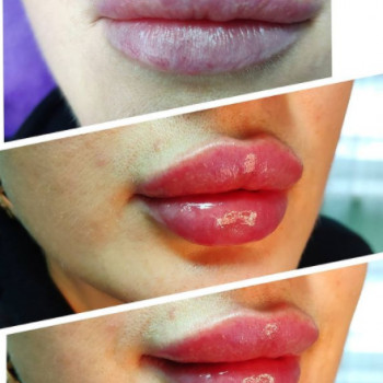 Светлана Овод, Шостка Фото - 5