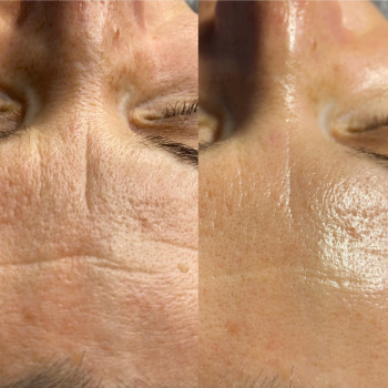 Ирина Малимоненко, Харків Фото - 32