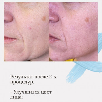 Ирина Малимоненко, Харків Фото - 38