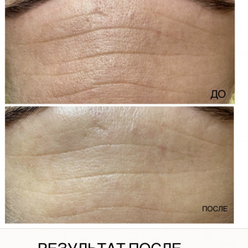 Ирина Малимоненко, Харків Фото - 40