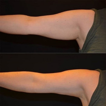 Лилия Заморская, Киев Фото - 28