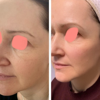 Ольга Костина, Киев Фото - 9