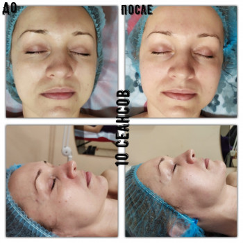 Татьяна Дрозда, Запоріжжя Фото - 9