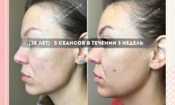 Буккальный & Миофасциальный массаж лица, шеи и головы Косметолог Жанна Киев