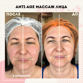 Буккальный & Миофасциальный массаж лица, шеи и головы
                    Косметолог Жанна Київ