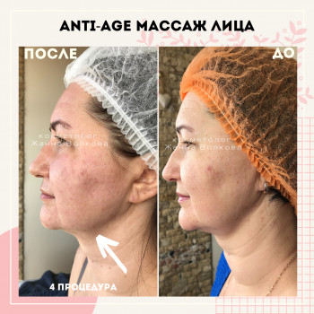 Буккальный & Миофасциальный массаж лица, шеи и головы
                    Косметолог Жанна Київ
