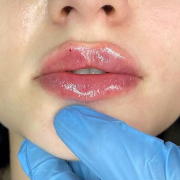 Кристина Шарапова, Ахтырка Фото - 6