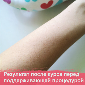 Soft Laser, Кременчуг Фото - 7