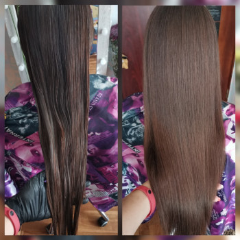 Биксипластия