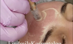 BB Glow Косметолог-инъекционист Людмила Одесса