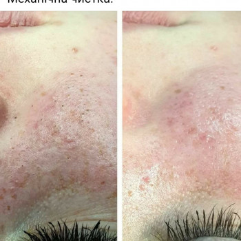 Наталья Сидоренко, Бахмач Фото - 5