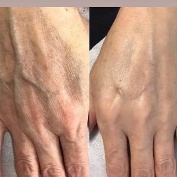 Ольга Микитчук, Харків Фото - 5