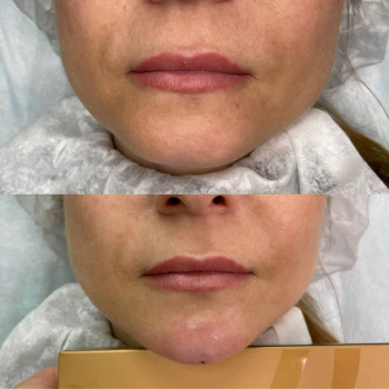 Ольга Микитчук, Харків Фото - 11