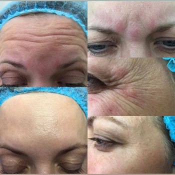 Ольга Микитчук, Харків Фото - 14