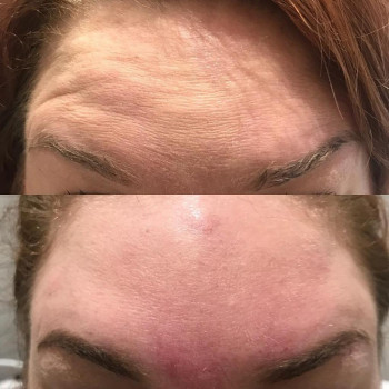 Ольга Микитчук, Харків Фото - 17