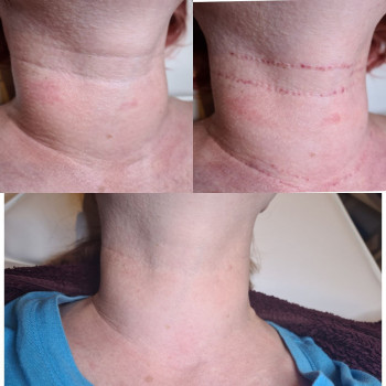 Ольга Микитчук, Харків Фото - 20