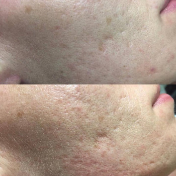 Ольга Микитчук, Харків Фото - 21