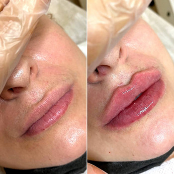 Ольга Микитчук, Харків Фото - 24