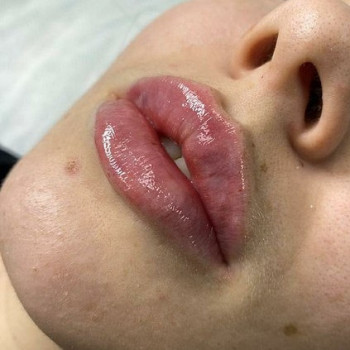 Ольга Микитчук, Харків Фото - 26