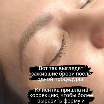 Зажившие бровки после 1-й процедуры