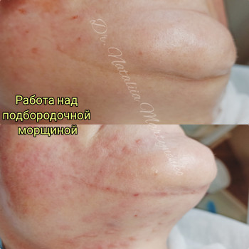 Наталия Мартыненко, Сумы Фото - 77