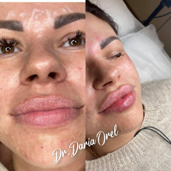 Дарья Орёл, Харків Фото - 6