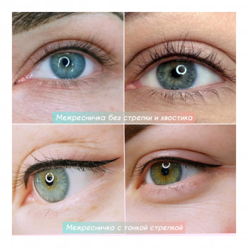 Різновид міжвійки