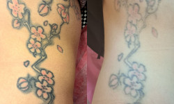 Удаление тату Майстер перманентного макіяжу Людмила Одеса