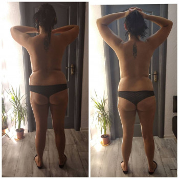 Курс вакуумно-роликового масажу