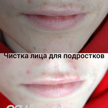 Людмила Коренко, Одесса Фото - 16