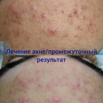 Людмила Коренко, Одесса Фото - 18