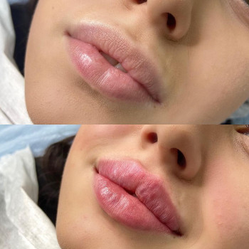 Людмила Коротченко, Черкассы Фото - 8