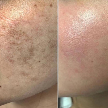 Людмила Коротченко, Черкассы Фото - 9